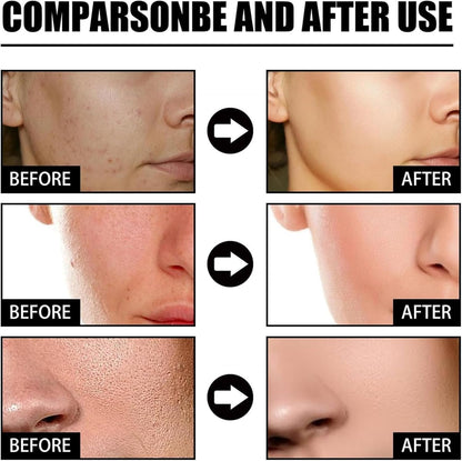 Facial Nicotinamide Serum